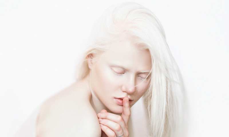 Can Albinos Color Their Hair? Find The Colorful Answer Here