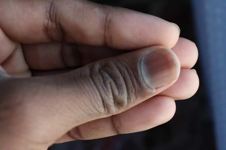 How To Get Rid Of Black Lines On Nails? Lauren+Vanessa